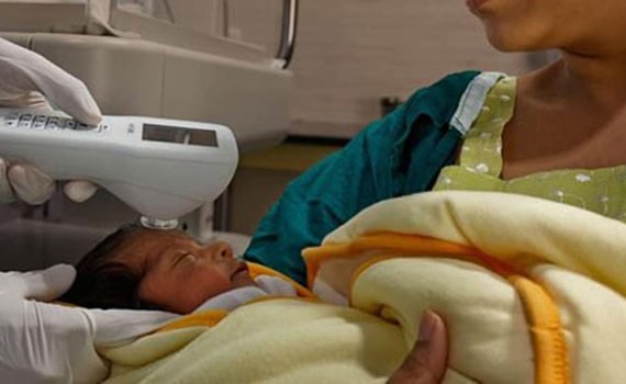 تشخیص زردی نوزاد با دستگاه بیلی چک