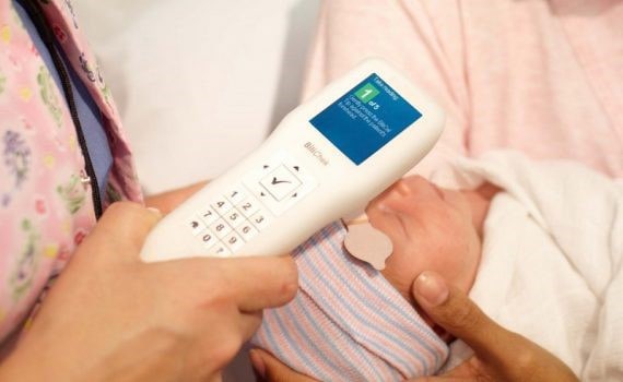 تشخیص زردی نوزاد با دستگاه بیلی چک