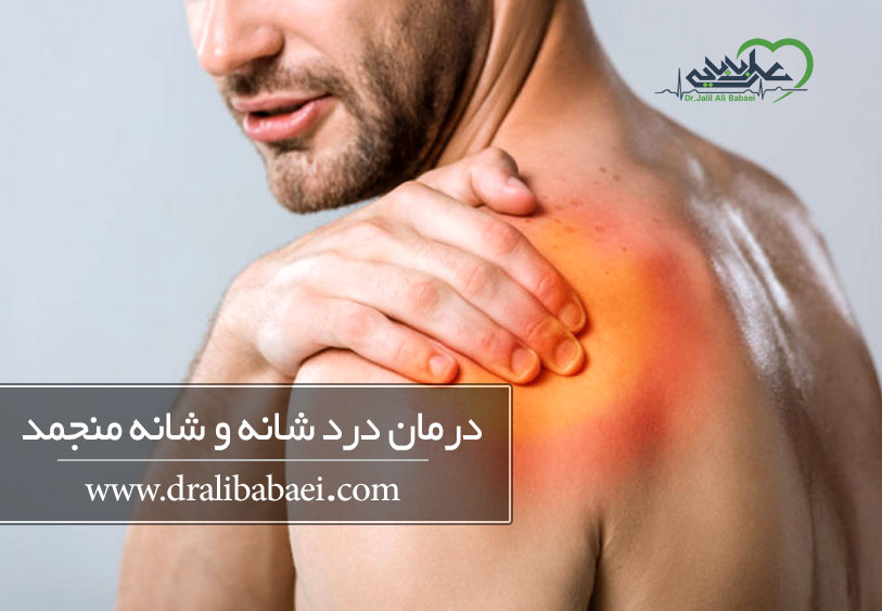درمان درد شانه و شانه منجمد