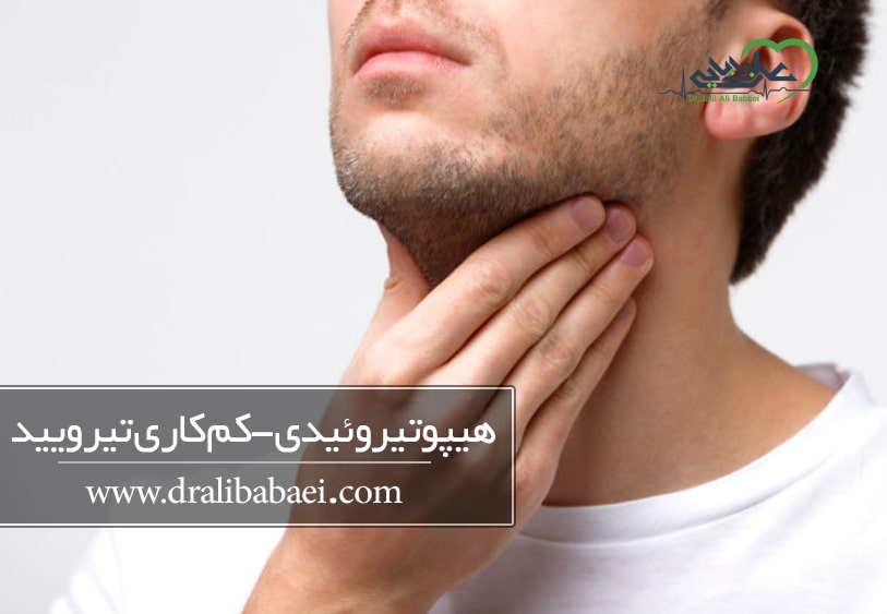 هیپوتیروئیدی (کم کاری تیرویید)
