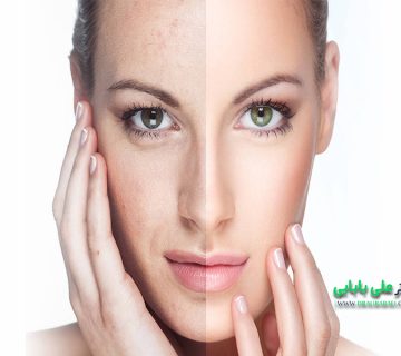 جوانسازی پوست صورت