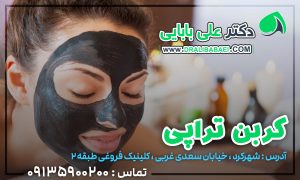 کربن تراپی شهرکرد