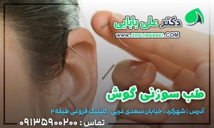 طب سوزنی گوش