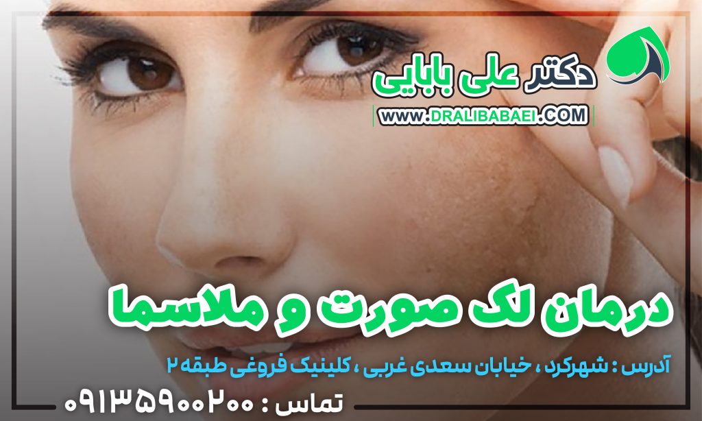 درمان لک صورت