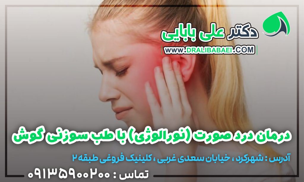 درمان نورالژی