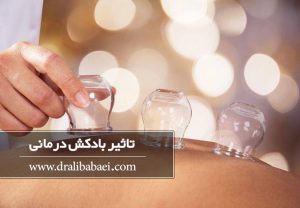 بادکش کردن بدن