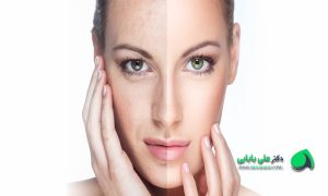 جوانسازی پوست صورت