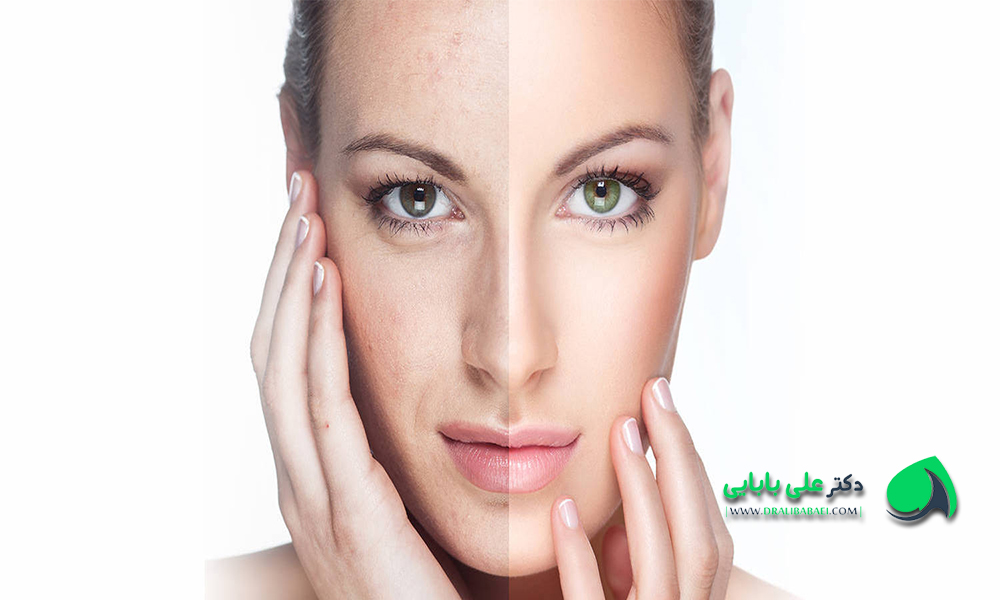 جوانسازی پوست صورت