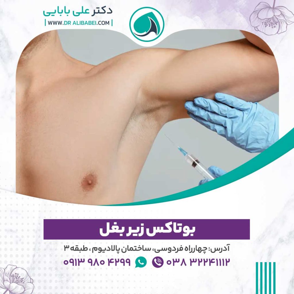 بوتاکس زیربعل 1024x1024