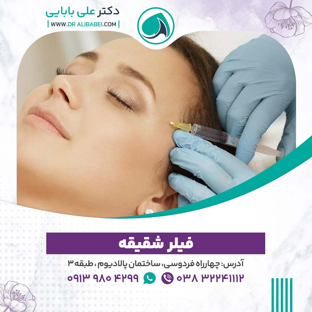 فیلر-شقیقه