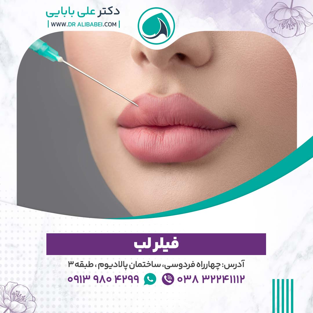 فیلر-لب-در-شهرکرد