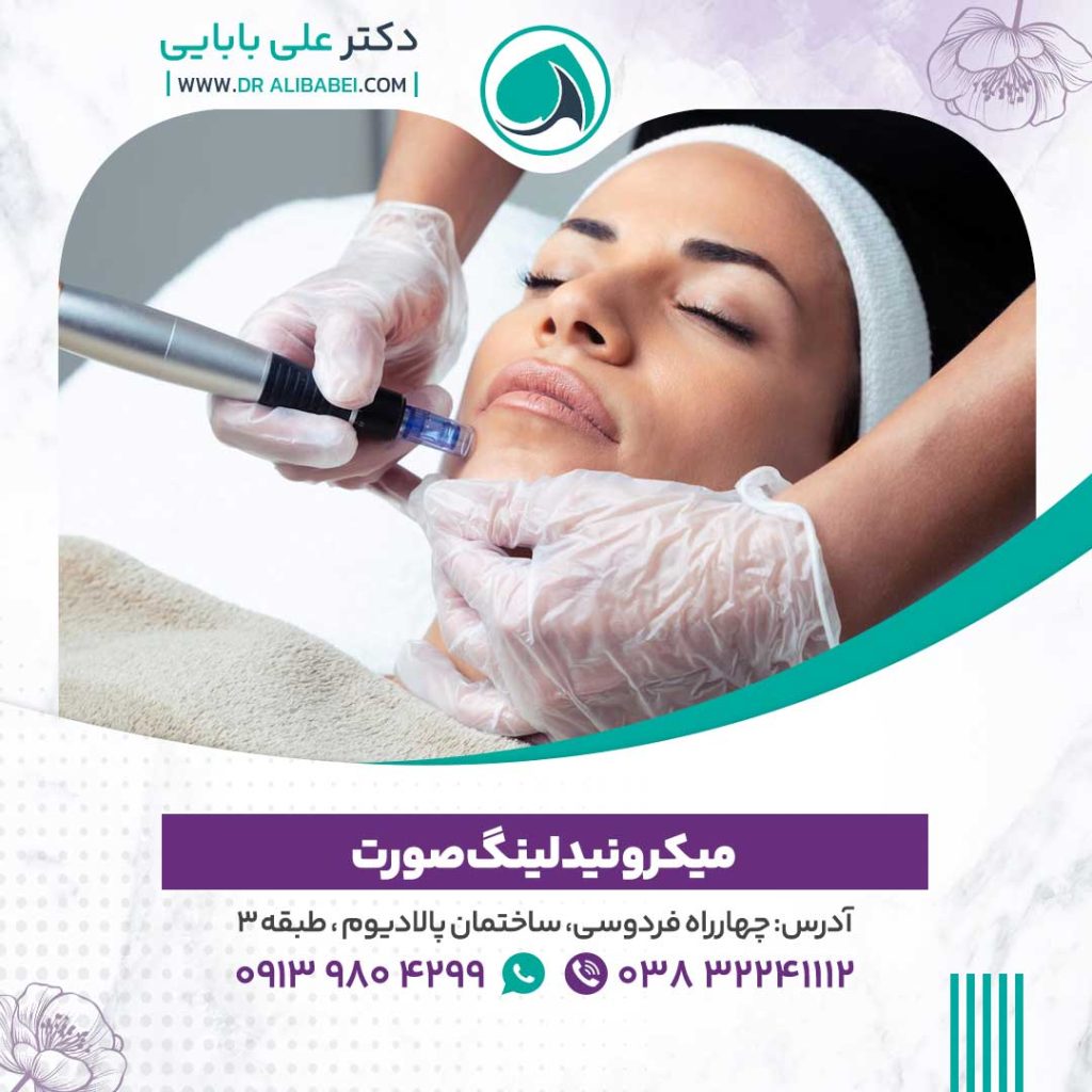 میکرونیدلنیگ صورت 1024x1024