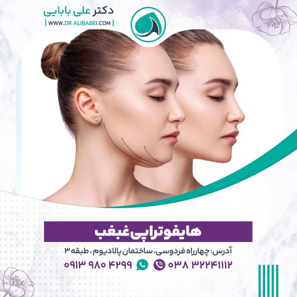 هایفو-تراپی-غبغب