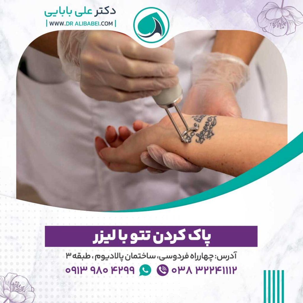 پاک کردن تتو 1024x1024