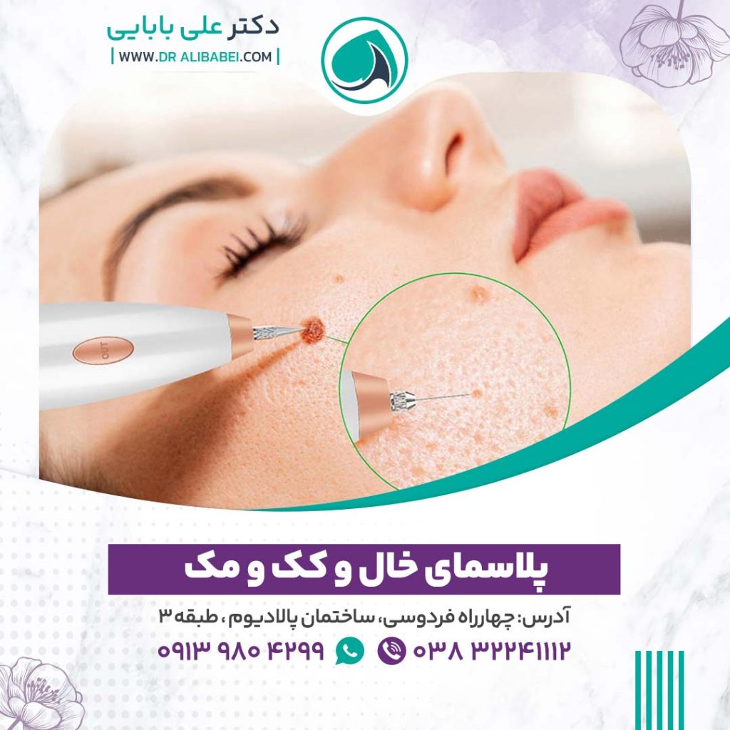 پلاسما فرکشنال 1024x1024