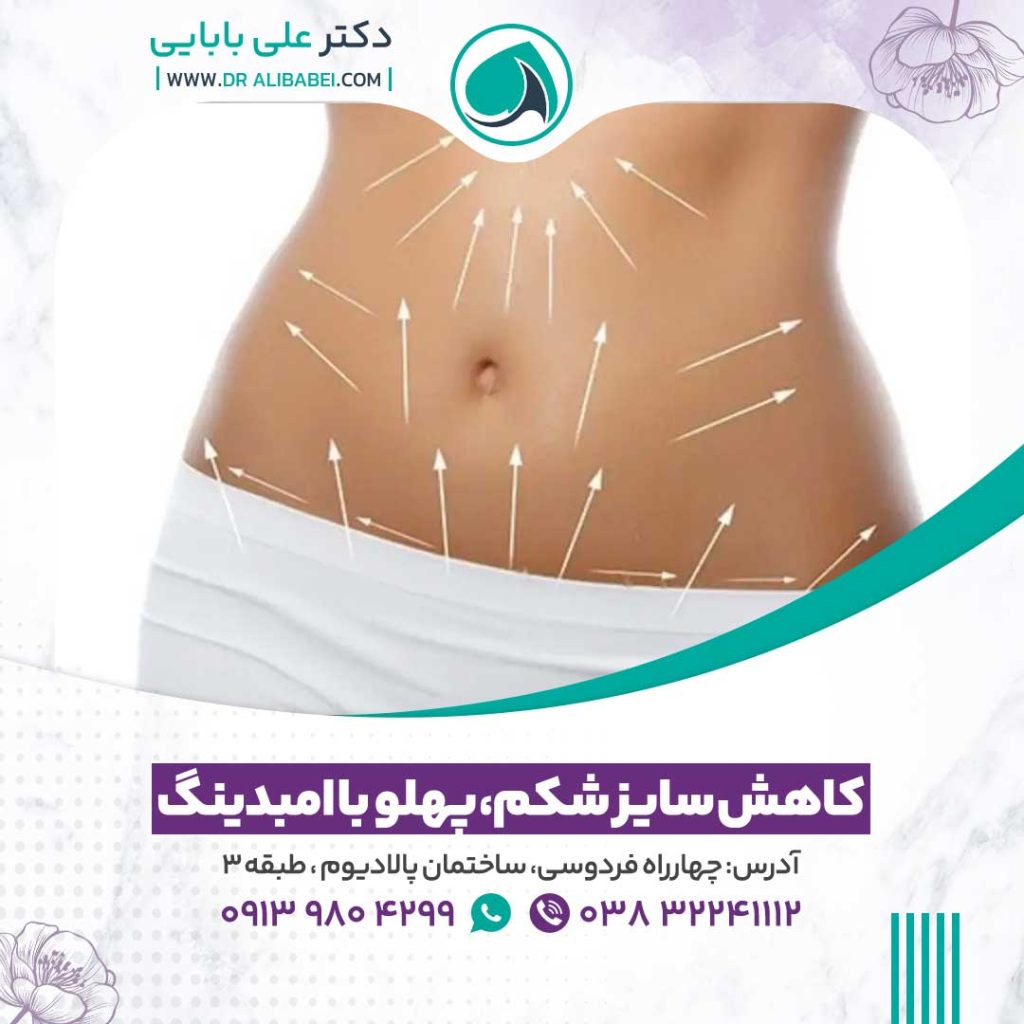 کاهش سایز شکم و پهلو با امبدینگ 1024x1024