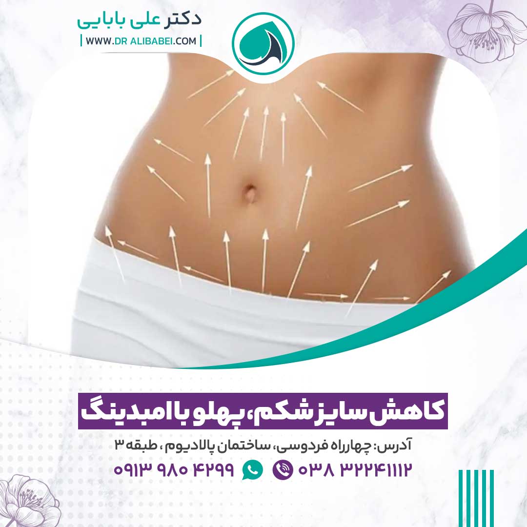 کاهش سایز شکم و پهلو با امبدینگ