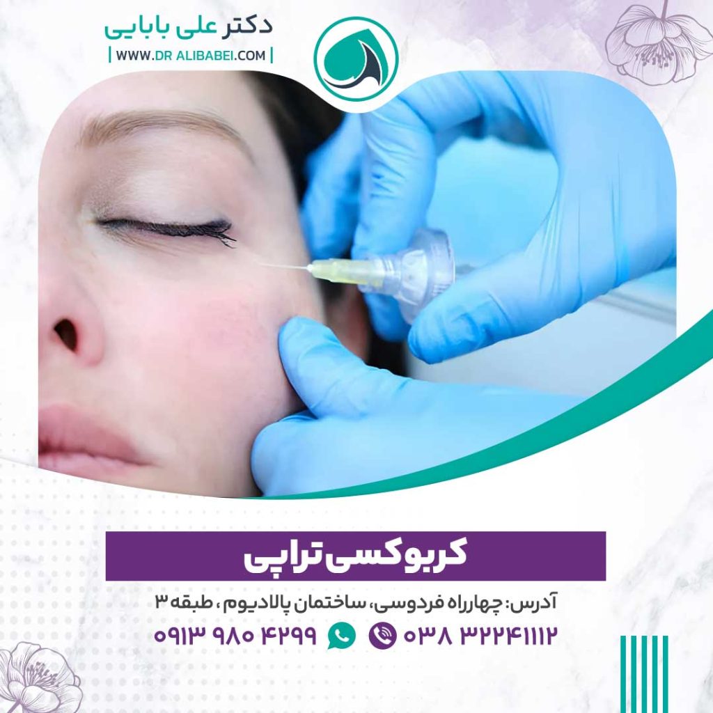 کربوکسی تراپی 1024x1024