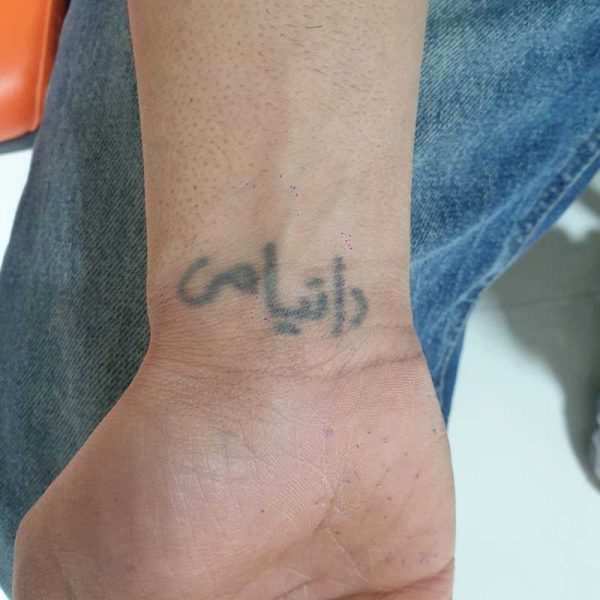 Zریمو تتو 2 600x600